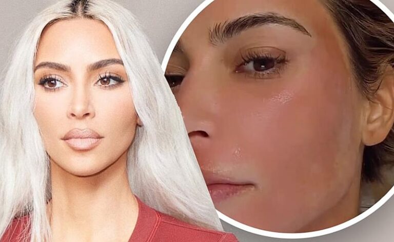 O que Hollywood está usando? Saiba como Kim Kardashian e outras celebridades estão rejuvenescendo de maneira rápida