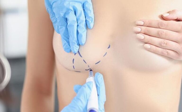 Dr. Octavio Curi Frascareli – Cirurgia da mulher moderna: a jovem mãe que se cuida e busca um resultado natural