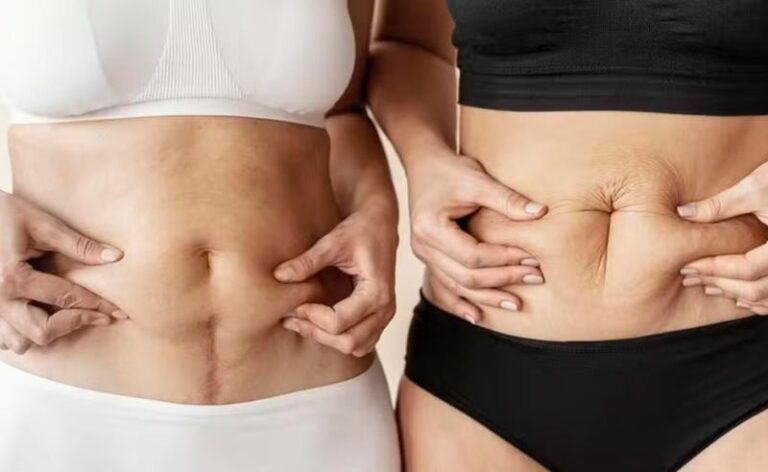 Dr. Octávio Curi Frascareli: Cirurgia da Mulher Moderna Pós-Gestação em Maringá: autoestima, firmeza e proporção