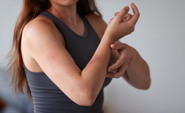 Dermatite e psoríase: por que as crises aumentam — e o que realmente ajuda a controlar a inflamação da pele