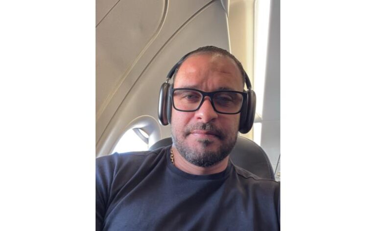 Transplante capilar ganha força entre famosos e impulsiona busca pelo procedimento