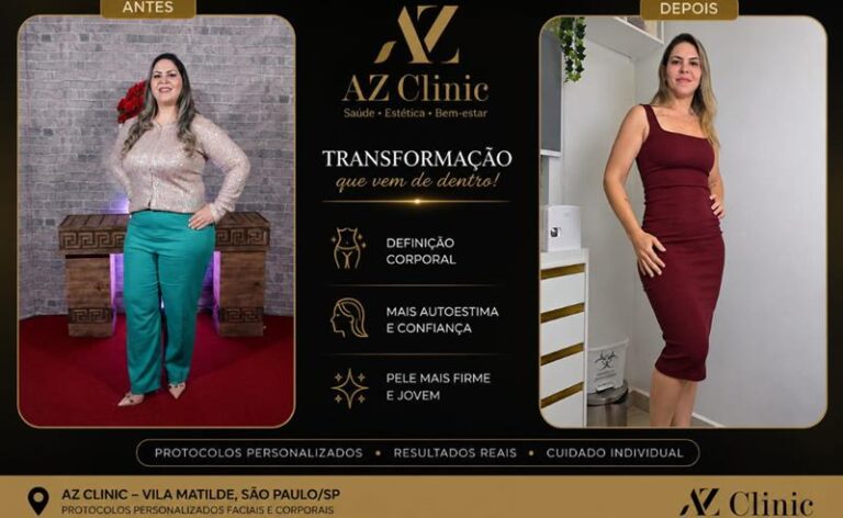 Da Superação ao Método Exclusivo: Como Dra. Aline Zanutto Transformou a Própria Jornada em Referência no Tratamento da Flacidez