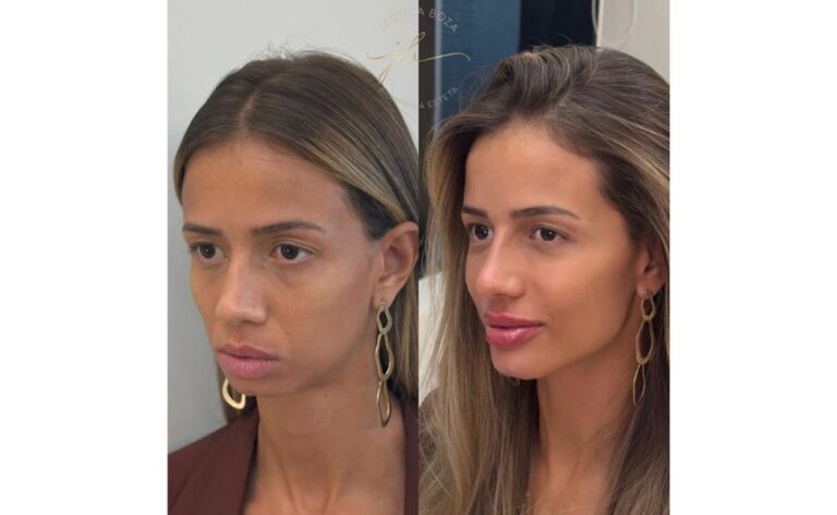 Beleza não é volume