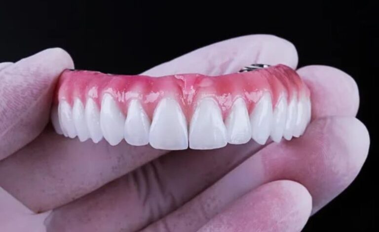 Dentadura ainda é coisa de avó? Especialista explica como as próteses mudaram e quando elas são indicadas