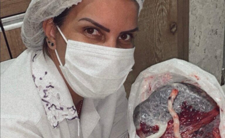 Terapia Bioplacentária: a pesquisa e o protocolo exclusivo da Dra. Silvana Correia ganha destaque internacional